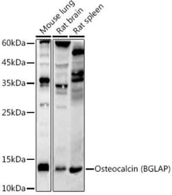 Osteocalcin Rabbit anti-Human, Mouse, Rat, Clone: 2T1J7, Novus Biologicals 20 &mu;g | Buy Online | Novus Biologicals | Fisher Scientific