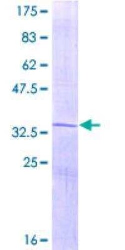 Novus Biologicals Recombinant Human Osteocalcin GST (N-Term) Protein 10 &mu;g | Buy Online | Novus Biologicals&trade; | Fisher Scientific