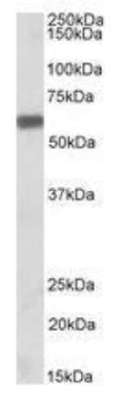 Osteopontin/OPN Antibody, Novus Biologicals 0.1mg; Unlabeled:Antibodies,