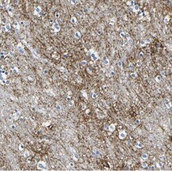 Otoferlin Antibody, Novus Biologicals 0.1mL; Unlabeled:Antibodies, Polyclonal