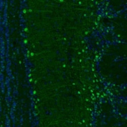 Otubain-1 Antibody, Novus Biologicals:Antibodies:Primary Antibodies