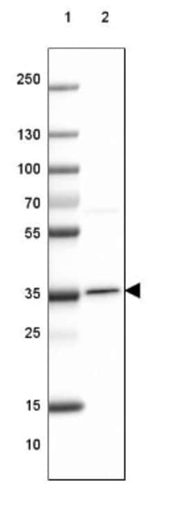 Otubain-1 Antibody, Novus Biologicals:Antibodies:Primary Antibodies
