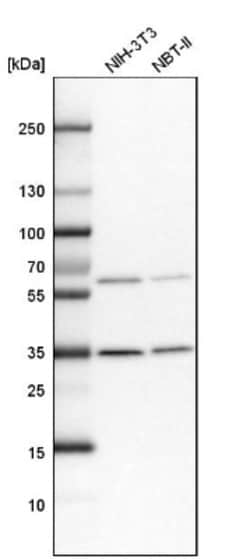 Otubain-1 Antibody, Novus Biologicals:Antibodies:Primary Antibodies
