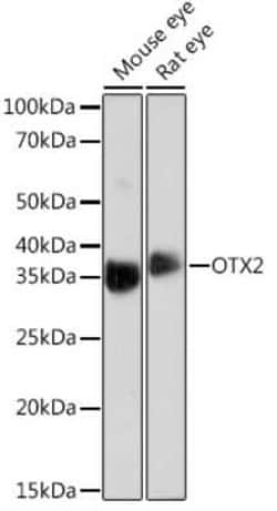 Otx2 Rabbit anti-Human, Mouse, Rat, Clone: 6I3J0, Novus Biologicals:Antibodies:Primary