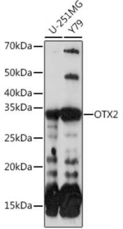 Otx2 Rabbit anti-Human, Mouse, Rat, Clone: 6I3J0, Novus Biologicals:Antibodies:Primary