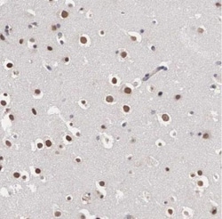 Otx2 Antibody, Novus Biologicals 25 &mu;L; Unlabeled:Antibodies, Polyclonal