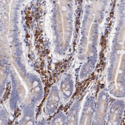 P-Rex1 Antibody, Novus Biologicals:Antibodies:Primary Antibodies