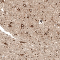 P-Rex1 Antibody, Novus Biologicals:Antibodies:Primary Antibodies