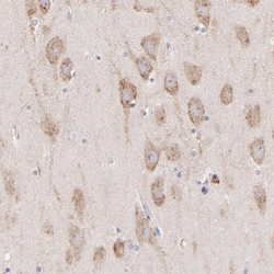 P-Rex1 Antibody, Novus Biologicals:Antibodies:Primary Antibodies