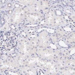 P-Rex1 Antibody, Novus Biologicals:Antibodies:Primary Antibodies