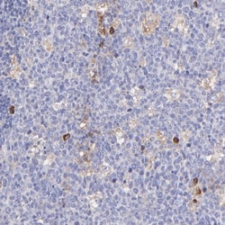 P-Rex1 Antibody, Novus Biologicals:Antibodies:Primary Antibodies