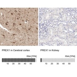 P-Rex1 Antibody, Novus Biologicals:Antibodies:Primary Antibodies
