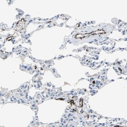P-Selectin/CD62P Antibody, Novus Biologicals 0.1mL; Unlabeled:Antibodies,