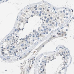 P-Selectin/CD62P Antibody, Novus Biologicals 0.1mL; Unlabeled:Antibodies,