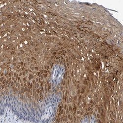 P11 Antibody, Novus Biologicals:Antibodies:Primary Antibodies