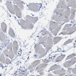 P11 Antibody, Novus Biologicals:Antibodies:Primary Antibodies