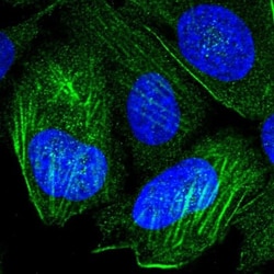 P2X4 Antibody, Novus Biologicals 0.1mL; Unlabeled:Antibodies, Polyclonal