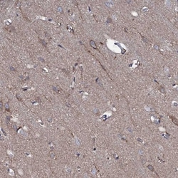 P2X4 Antibody, Novus Biologicals 0.1mL; Unlabeled:Antibodies, Polyclonal