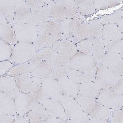 P2X4 Antibody, Novus Biologicals 0.1mL; Unlabeled:Antibodies, Polyclonal
