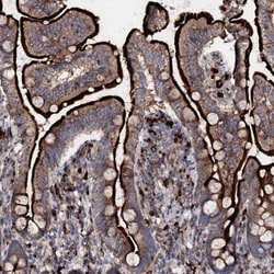 P2X4 Antibody, Novus Biologicals 0.1mL; Unlabeled:Antibodies, Polyclonal