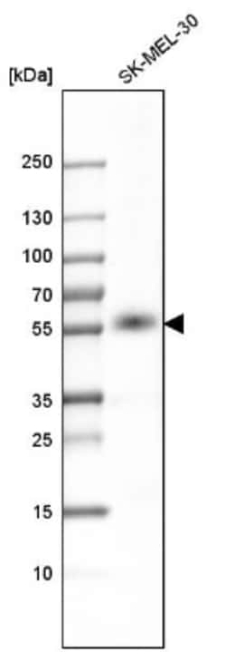 P2X4 Antibody, Novus Biologicals 0.1mL; Unlabeled:Antibodies, Polyclonal
