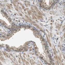 P2Y1/P2RY1 Antibody, Novus Biologicals 25 &mu;L; Unlabeled:Antibodies,