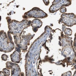 P2Y1/P2RY1 Antibody, Novus Biologicals 25 &mu;L; Unlabeled:Antibodies,