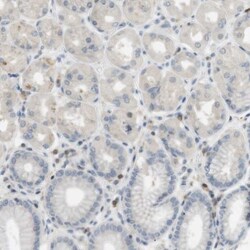 P2Y1/P2RY1 Antibody, Novus Biologicals 25 &mu;L; Unlabeled:Antibodies,
