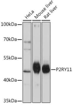 P2Y11/P2RY11 Rabbit anti-Human, Mouse, Rat, Polyclonal, Novus Biologicals