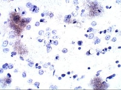 P2Y12/P2RY12 Antibody, Novus Biologicals 0.1 mg; Unconjugated:Antibodies,
