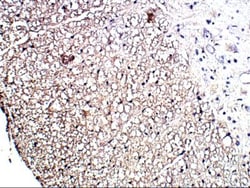 P2Y12/P2RY12 Antibody, Novus Biologicals 0.1 mg; Unconjugated:Antibodies,