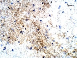 P2Y12/P2RY12 Antibody, Novus Biologicals 0.1 mg; Unconjugated:Antibodies,