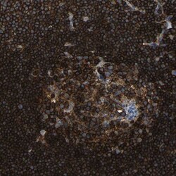P2Y12/P2RY12 Antibody, Novus Biologicals 0.1mL; Unlabeled:Antibodies, Polyclonal