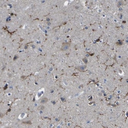 P2Y12/P2RY12 Antibody, Novus Biologicals 0.1mL; Unlabeled:Antibodies, Polyclonal