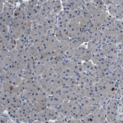 P2Y12/P2RY12 Antibody, Novus Biologicals 0.1mL; Unlabeled:Antibodies, Polyclonal