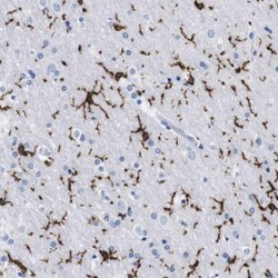 P2Y12/P2RY12 Antibody, Novus Biologicals 0.1mL; Unlabeled:Antibodies