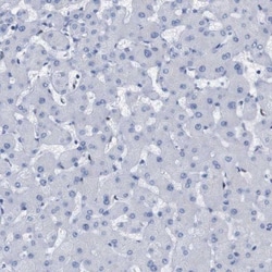 P2Y12/P2RY12 Antibody, Novus Biologicals 0.1mL; Unlabeled:Antibodies