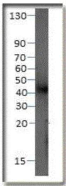 P2Y12/P2RY12 Antibody, Novus Biologicals 0.1 mg; Unconjugated:Antibodies,