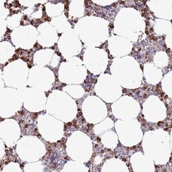P2Y13/P2RY13/GPR86 Antibody, Novus Biologicals 0.1mL; Unlabeled:Antibodies,
