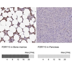 P2Y13/P2RY13/GPR86 Antibody, Novus Biologicals 0.1mL; Unlabeled:Antibodies,