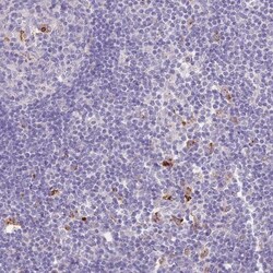 P2Y13/P2RY13/GPR86 Antibody, Novus Biologicals 0.1mL; Unlabeled:Antibodies,