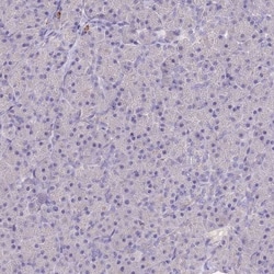 P2Y13/P2RY13/GPR86 Antibody, Novus Biologicals 0.1mL; Unlabeled:Antibodies,