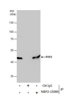 P2Y2 Antibody, Novus Biologicals 0.1mL; Unlabeled:Antibodies, Polyclonal