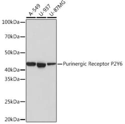 P2Y6/P2RY6 Rabbit anti-Human, Clone: 4I8C9, Novus Biologicals 20 &mu;g;