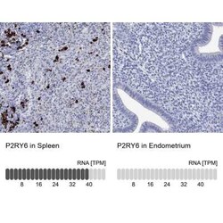 P2Y6/P2RY6 Rabbit anti-Human, Polyclonal, Novus Biologicals 25 &mu;g; Unconjugated:Antibodies,