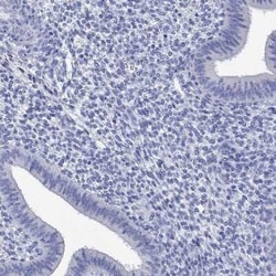 P2Y6/P2RY6 Rabbit anti-Human, Polyclonal, Novus Biologicals 25 &mu;g; Unconjugated:Antibodies,