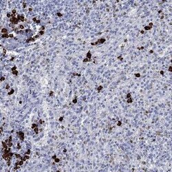 P2Y6/P2RY6 Rabbit anti-Human, Polyclonal, Novus Biologicals 25 &mu;g; Unconjugated:Antibodies,
