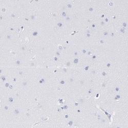 P2Y8 Antibody, Novus Biologicals:Antibodies:Primary Antibodies