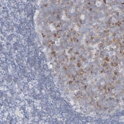 P2Y8 Antibody, Novus Biologicals:Antibodies:Primary Antibodies
