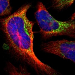 P4HA1 Antibody, Novus Biologicals 0.1mL; Unlabeled:Antibodies, Polyclonal
